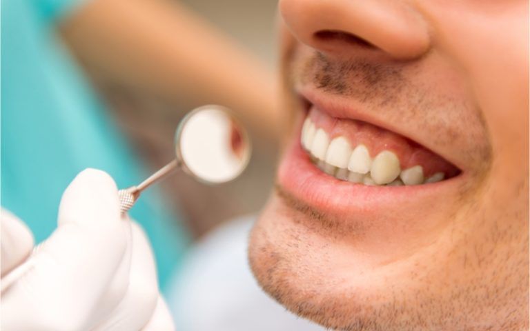 teeth cleaning heidarian