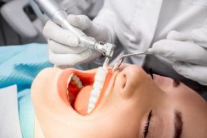 Woman getting her teeth professionally cleaned
