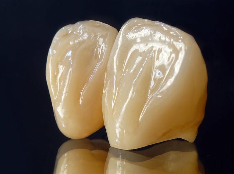 Dental crowns on a black background